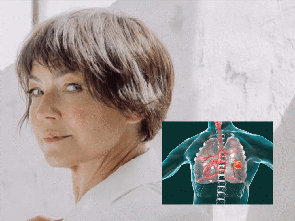 Claudia Schmutzler Lungenkrebs